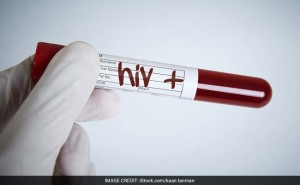  Vaksin HIV , HIV , vaksin berbasis DNA