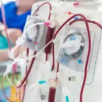 Kasus Gagal Ginjal Meningkat, Tempat Cuci Darah di Purworejo Nyaris Penuh