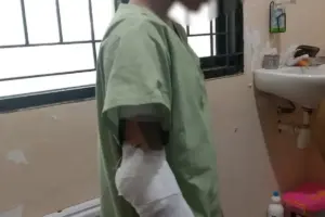 Bocah Perempuan di Semarang Diduga Dibakar Paman, Awalnya gara-gara Tak Mau Mandi