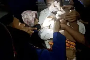 THT Tutup, Damkar Tangerang Evakuasi Biji Tasbih dari Hidung Balita